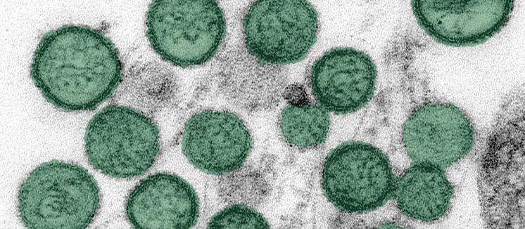Imagem microscópica do vírus da hantavirose. Foto: Divulgação/CDC